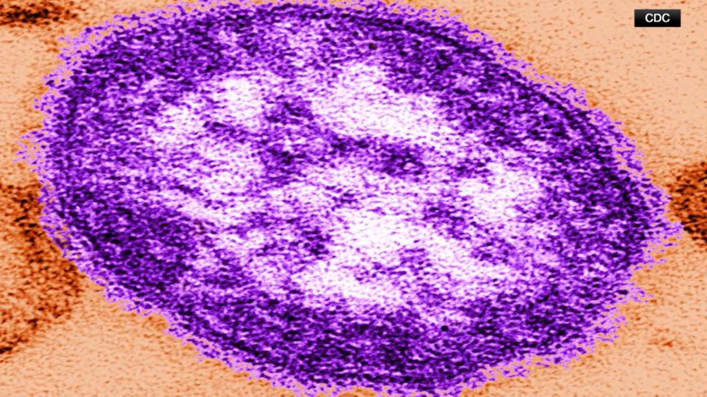 Measles Outbreak in Pennsylvania Highlights Vaccine Skepticism and Public Health Trust