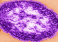 Measles Outbreak in Pennsylvania Highlights Vaccine Skepticism and Public Health Trust