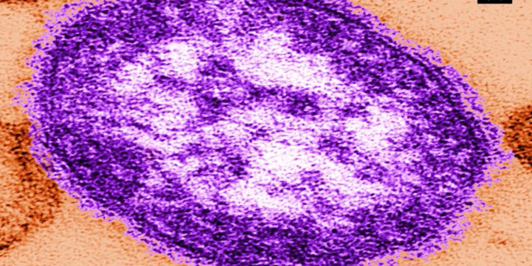 CDC